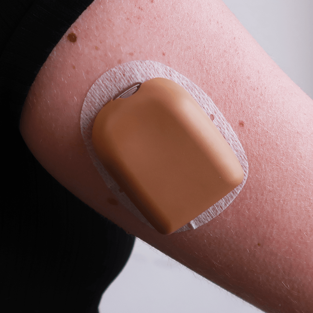 SugarFam Omnipod Cover - Sweet Caramel - The Useless Pancreas