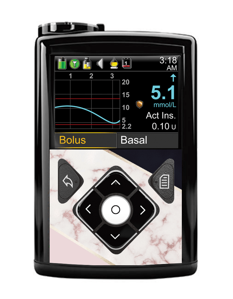 Medtronic 640G/670G Button Panel Sticker (Blush Marble) - The Useless Pancreas