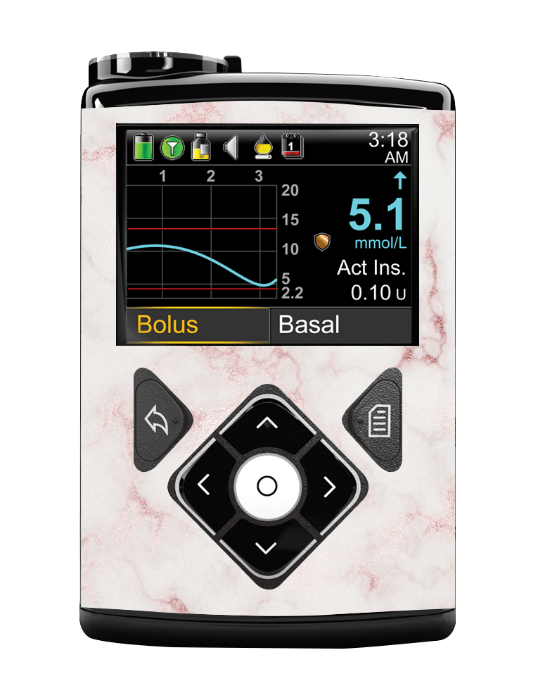 Medtronic 640/670/780G Pump Sticker (Marble Dreams) - The Useless Pancreas