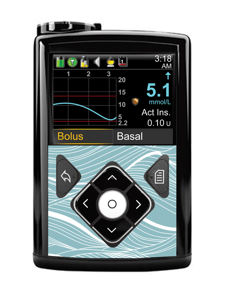 Medtronic 640G/670G Button Panel Sticker (Making Waves) - The Useless Pancreas
