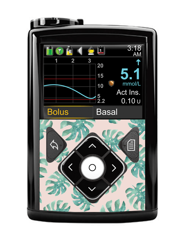 Medtronic 640G/670G Button Panel Sticker (Tropical Vibes) - The Useless Pancreas
