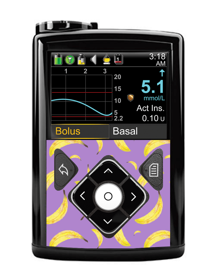 Medtronic 640G/670G Button Panel Sticker (Go Bananas) - The Useless Pancreas