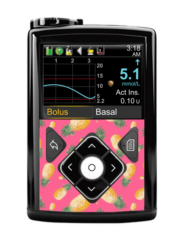 Medtronic 640G/670/780G Button Panel Sticker (Pink Pineapples) - The Useless Pancreas