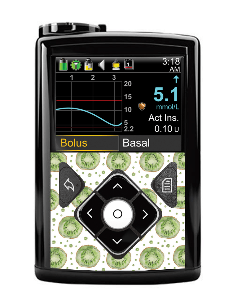 Medtronic 640G/670G Button Panel Sticker (Kiwi Life) - The Useless Pancreas