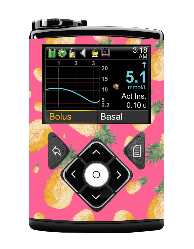 Medtronic 640/670/780G Pump Sticker (Pink Pineapples) - The Useless Pancreas