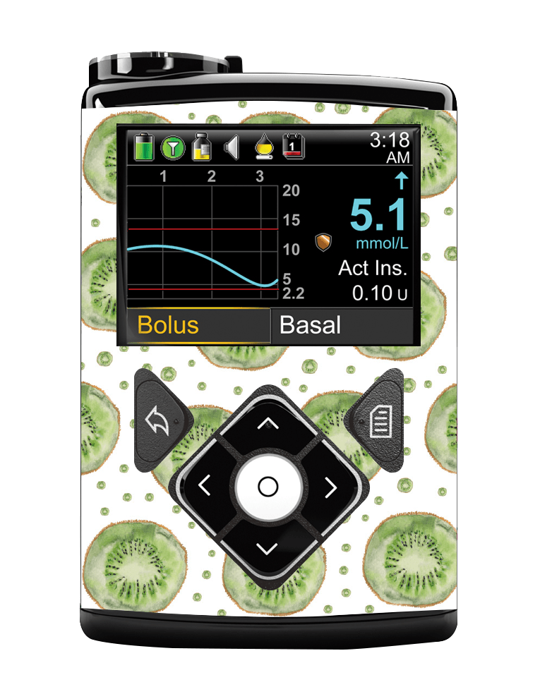 Medtronic 640/670G Pump Sticker (Kiwi Life) - The Useless Pancreas