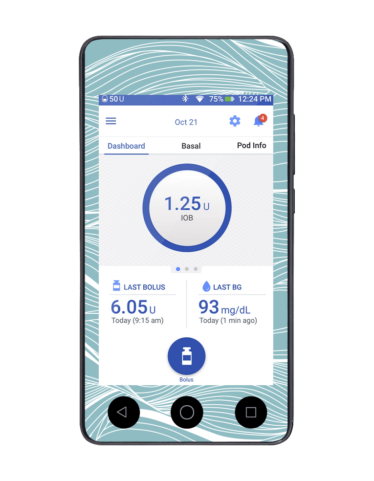Omnipod DASH Cover (Making Waves) - The Useless Pancreas