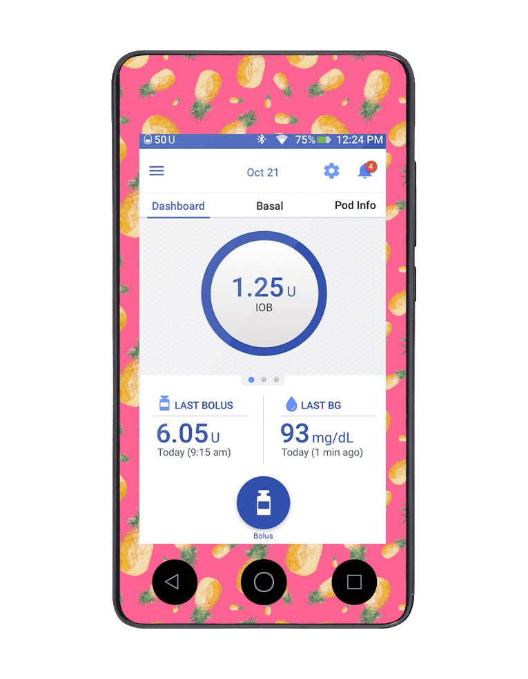 Omnipod DASH Cover (Pink Pineapples) - The Useless Pancreas