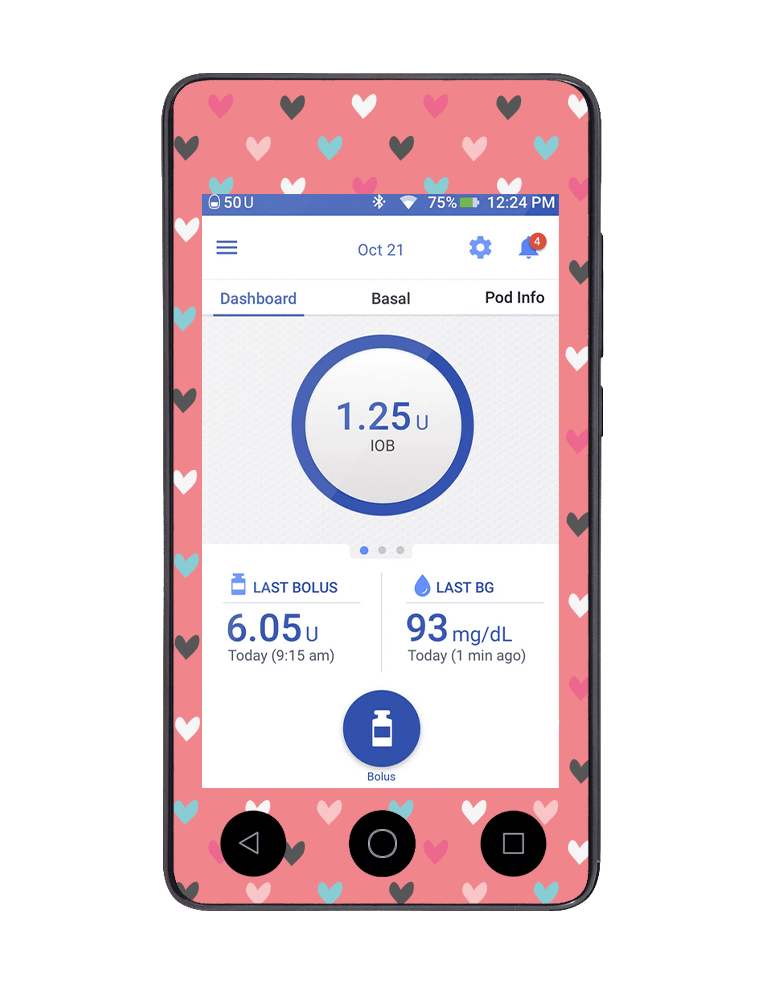 Omnipod DASH Cover (Heart to Heart) - The Useless Pancreas