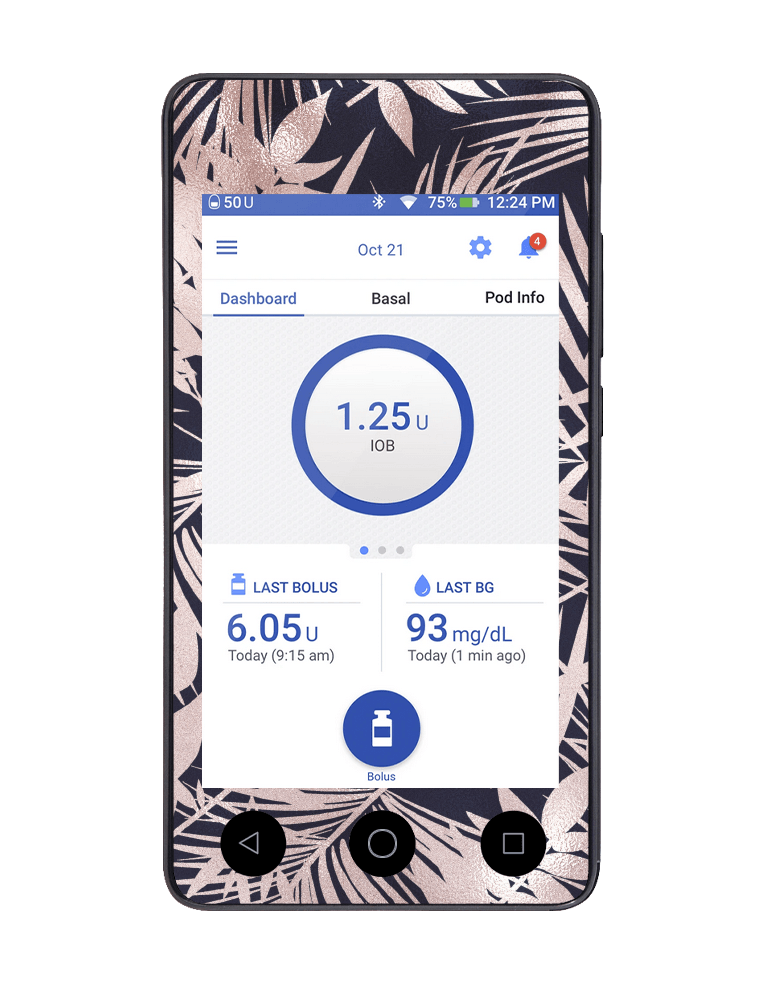 Omnipod DASH Cover (Palm Springs) - The Useless Pancreas