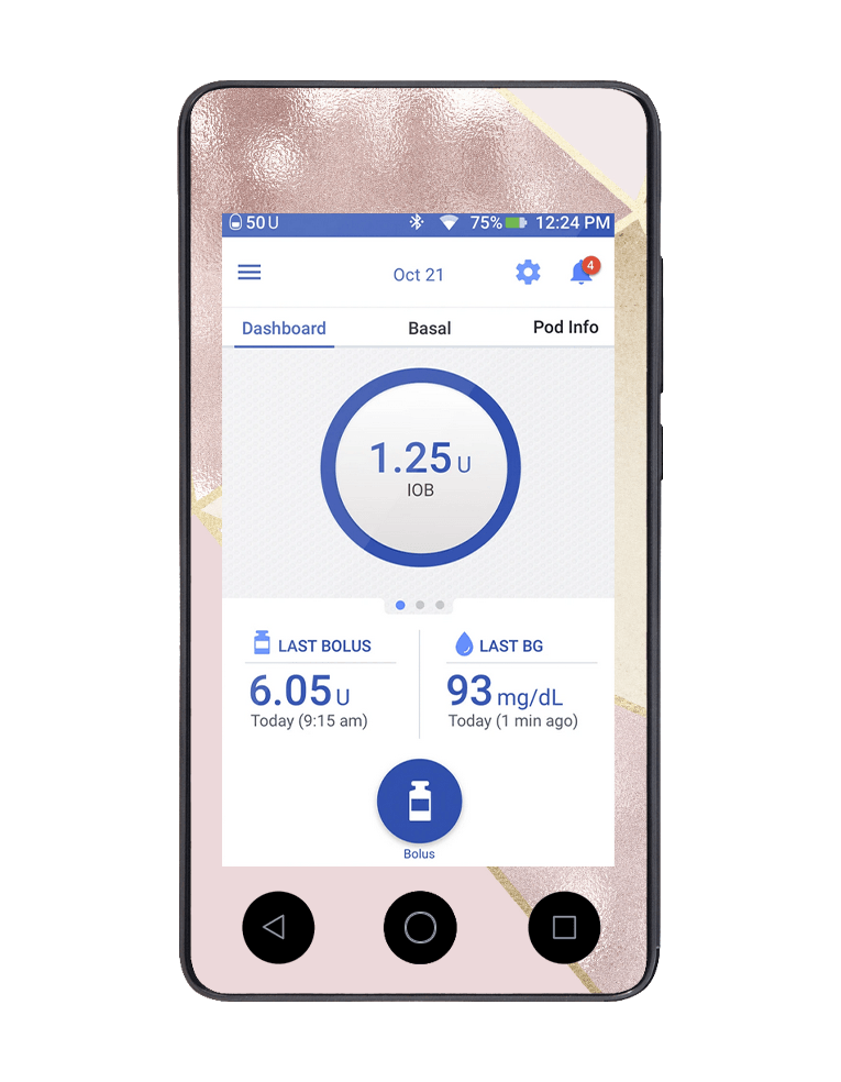 Omnipod DASH Cover (Blush Geo) - The Useless Pancreas