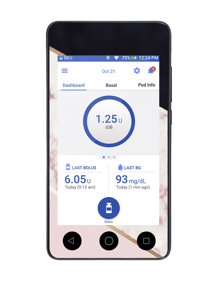 Omnipod DASH Cover (Blush Marble) - The Useless Pancreas