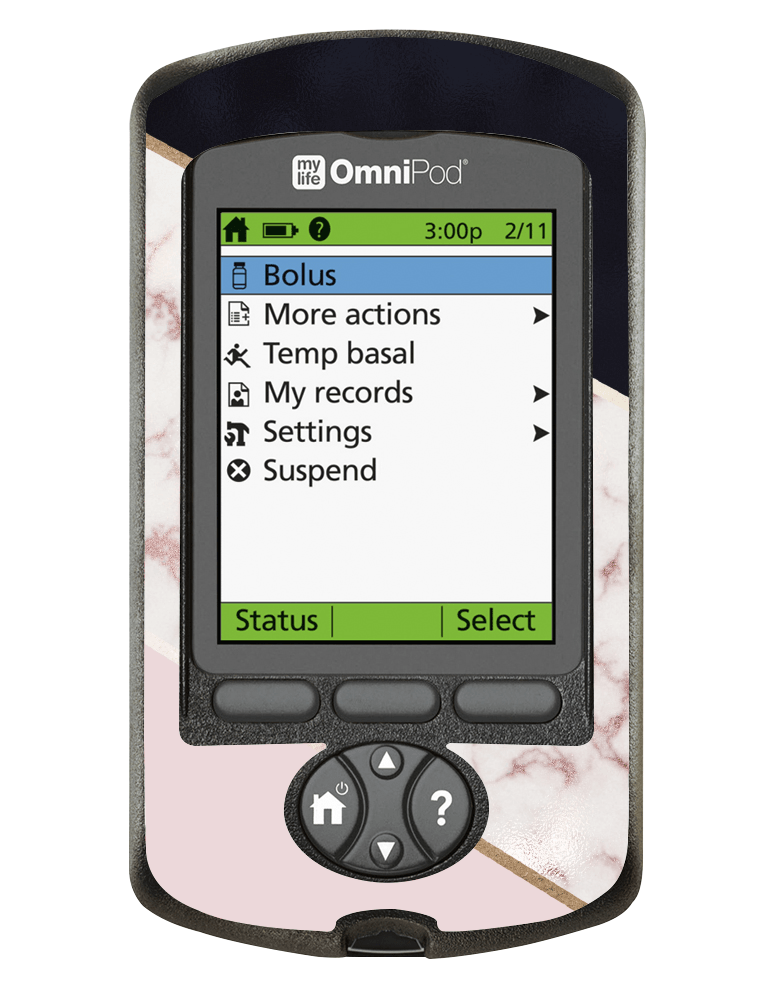 Omnipod PDM Cover (Blush Marble) - The Useless Pancreas