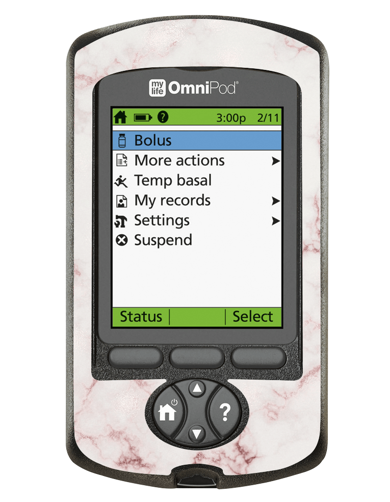 Omnipod PDM Cover (Marble Dreams) - The Useless Pancreas