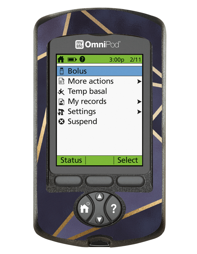 Omnipod PDM Cover (Navy Geo) - The Useless Pancreas