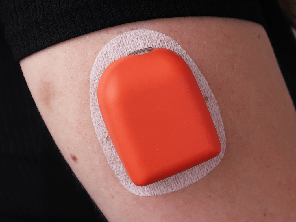 SugarFam Omnipod Cover - Sunset - The Useless Pancreas