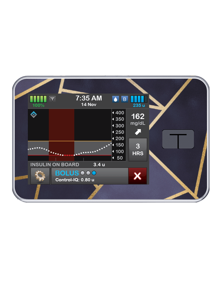 T:slim Cover Sticker (Navy Geo) - The Useless Pancreas