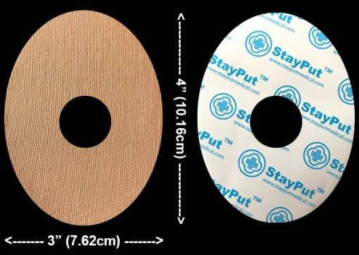 DB3 StayPut Patch – 1″ Circular Hole – 30 Pack (Fits Freestyle Libre & most infusion sets)