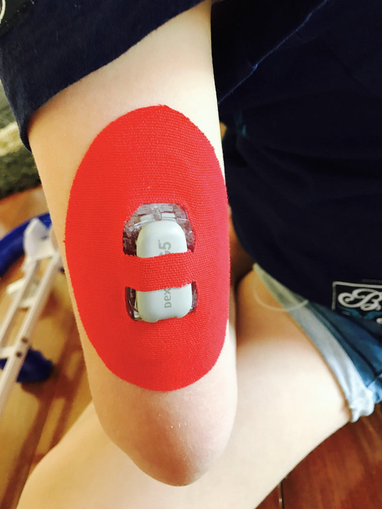 Dexcom Oval Shaped with Overtape Patches
