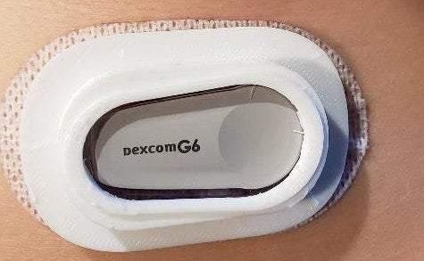 Reusable Dexcom G6 Cover-Over Patch Use – The Useless Pancreas