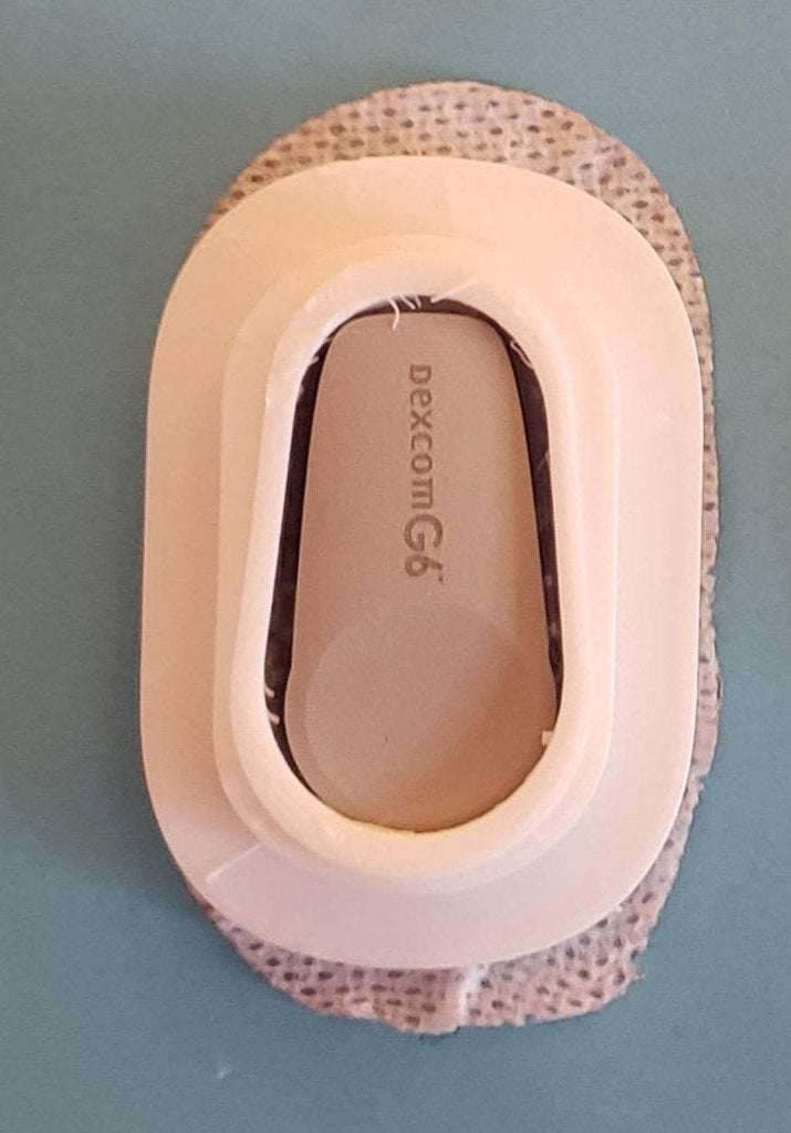 Reusable Dexcom G6 Cover-Over Patch Use - The Useless Pancreas