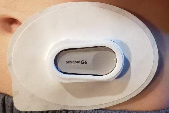 Reusable Dexcom G6 Cover-Over Patch Use – The Useless Pancreas