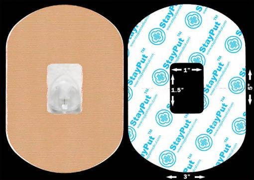 StayPut Patch Sample - The Useless Pancreas