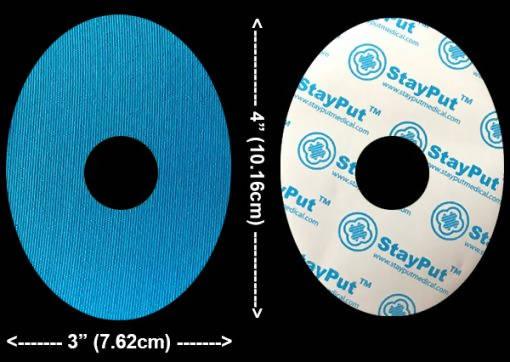 StayPut Patch Sample - The Useless Pancreas