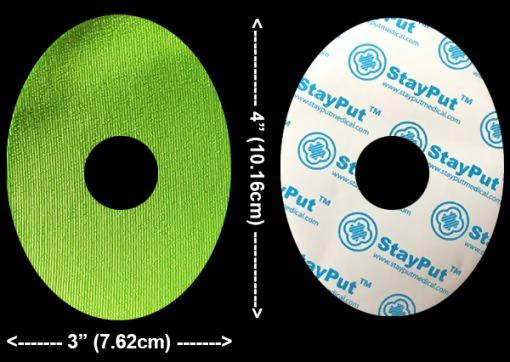 StayPut Patch Sample - The Useless Pancreas